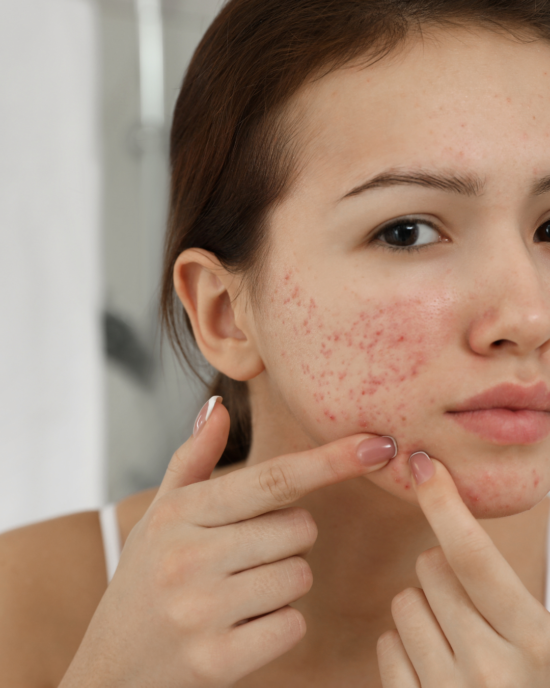 Como o Estresse Afeta a Pele — e Como a Nutrição Pode Te Ajudar